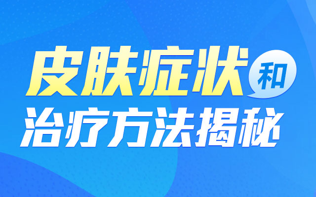 青岛哪家白癜风医院好?皮肤白癜风诊治医院